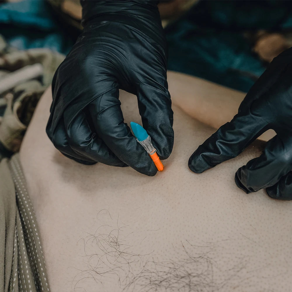 RHINO RESCUE Pneumothorax Needle: Expert Emergency Chest Ventilation & Decompression Kit,Chest Wound Care